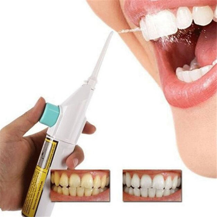 Irrigador bucal portátil, higiene Dental, hilo Dental, irrigador de agua, limpieza por chorro, limpiador de dentaduras bucales, irrigador bucal