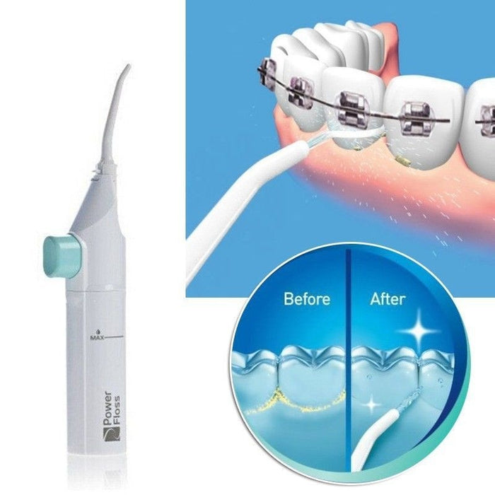 Irrigador bucal portátil, higiene Dental, hilo Dental, irrigador de agua, limpieza por chorro, limpiador de dentaduras bucales, irrigador bucal