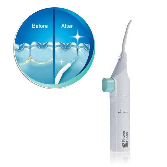 Irrigador bucal portátil, higiene Dental, hilo Dental, irrigador de agua, limpieza por chorro, limpiador de dentaduras bucales, irrigador bucal